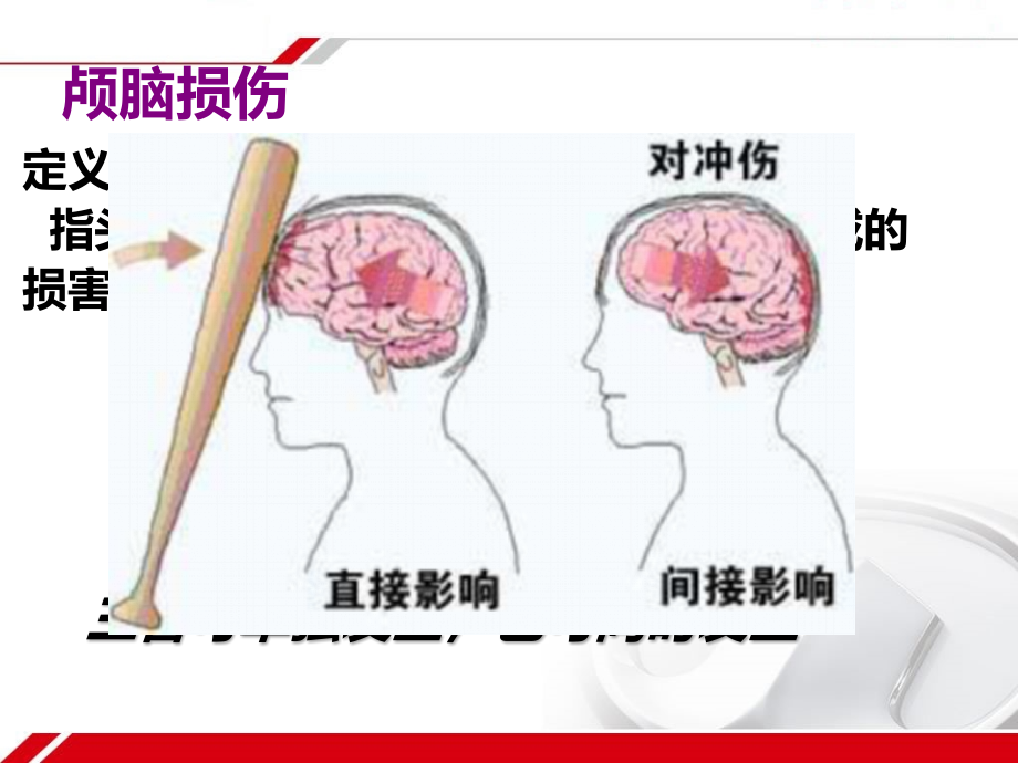 颅脑损伤病人的护理优选课件