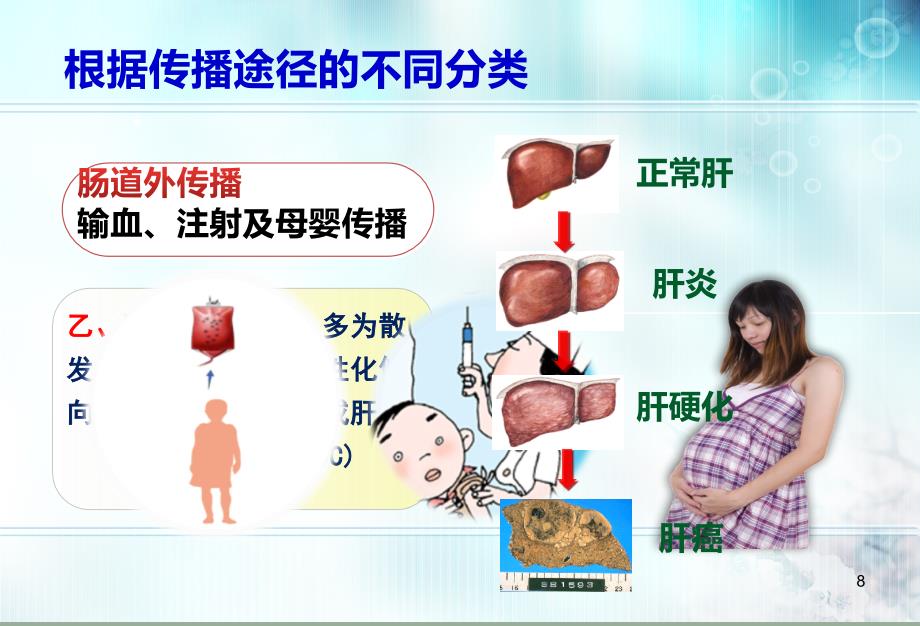 流行性肝炎图片