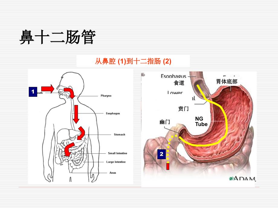 鼻肠管种类图片