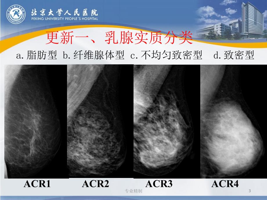 birads分類更新解讀乳腺鉬靶薈萃知識