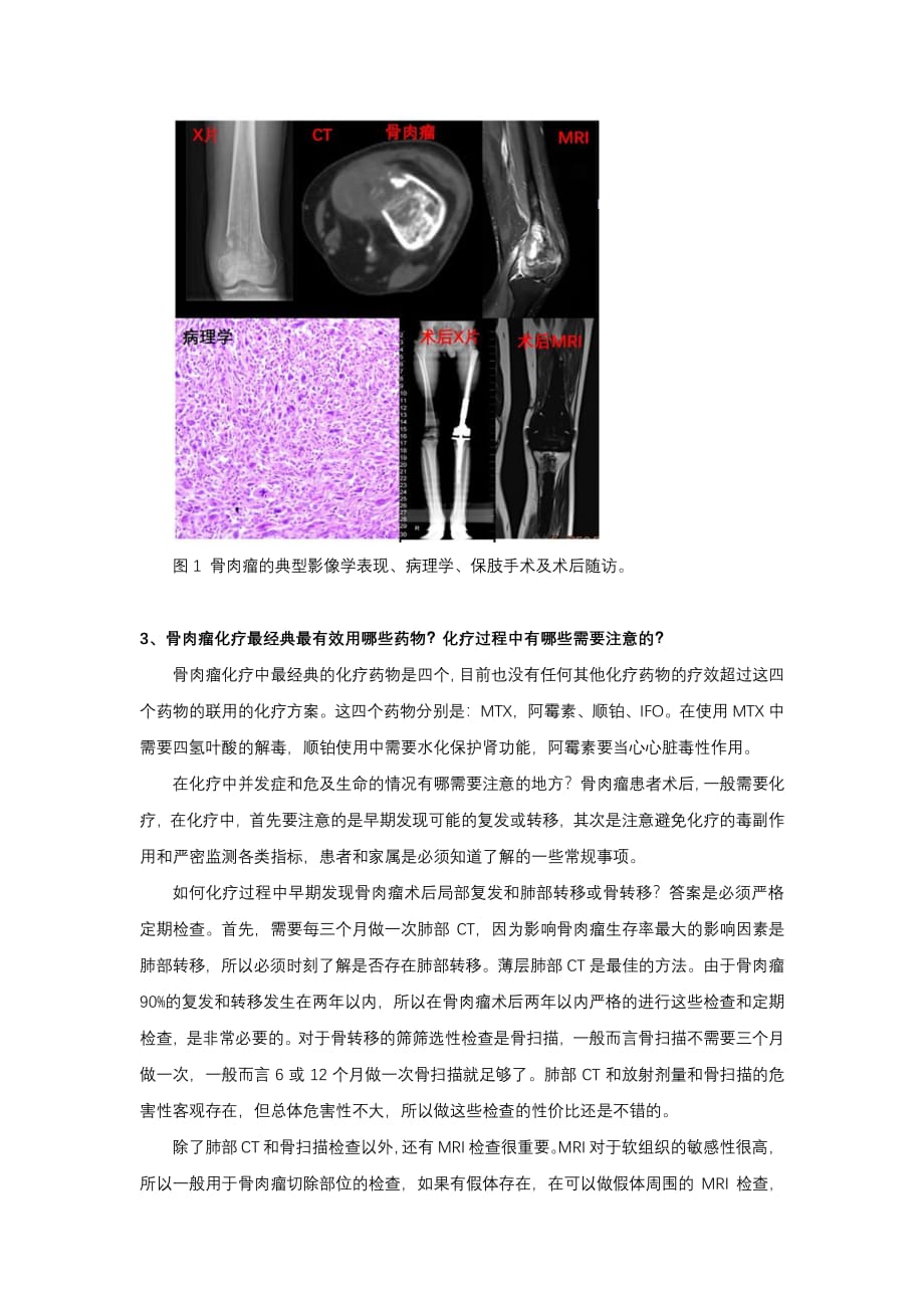 骨肉瘤所有重内容及最近进展