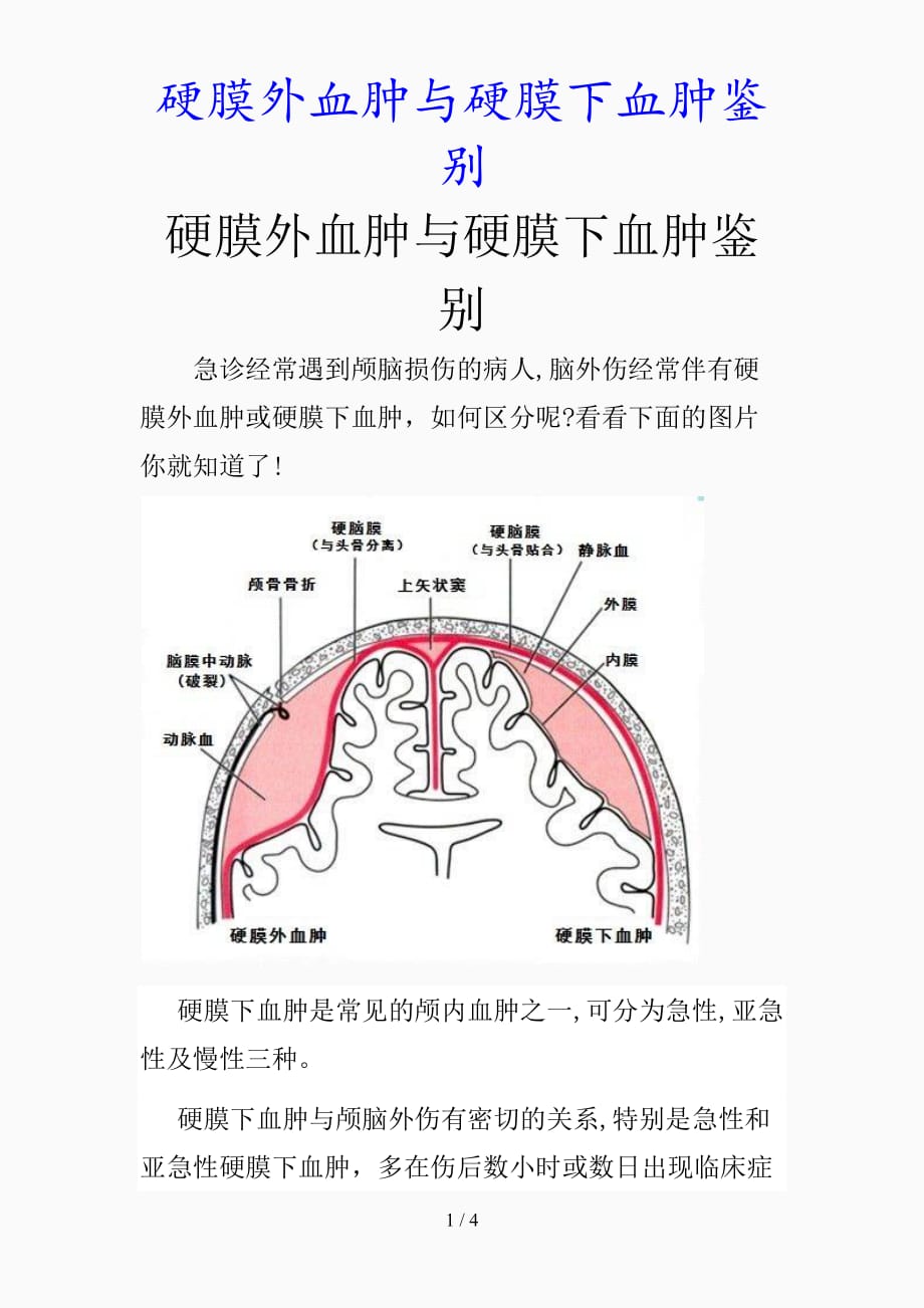 最新硬膜外血腫與硬膜下血腫鑑別精品課件