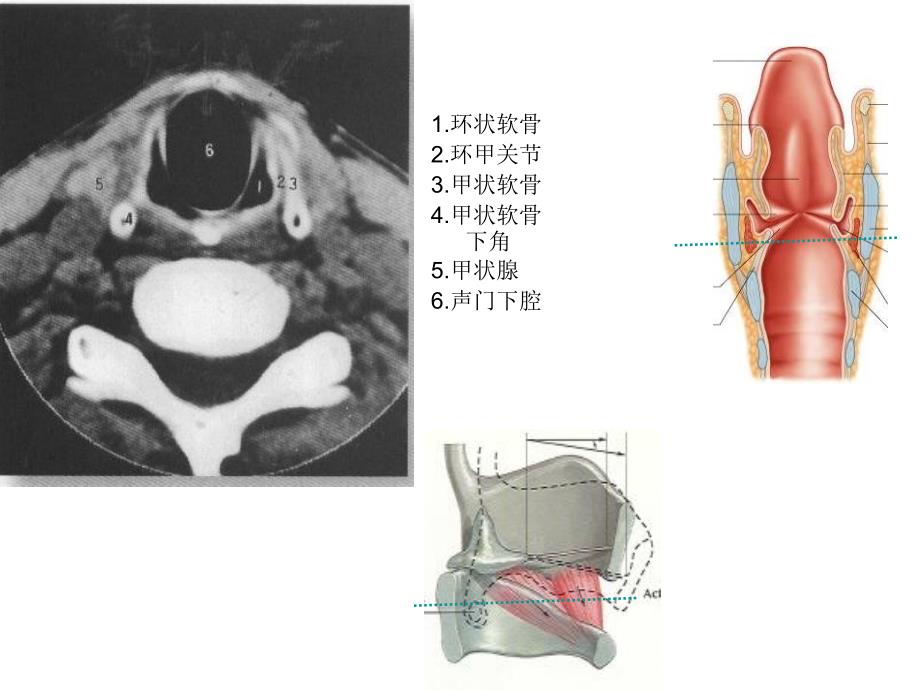舌下腺ct断层解剖图图片